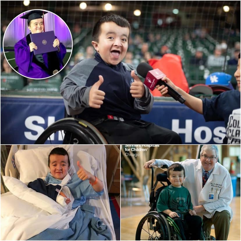 UPDATE: He was born with very fragile bones; even a light touch could cause them to break.