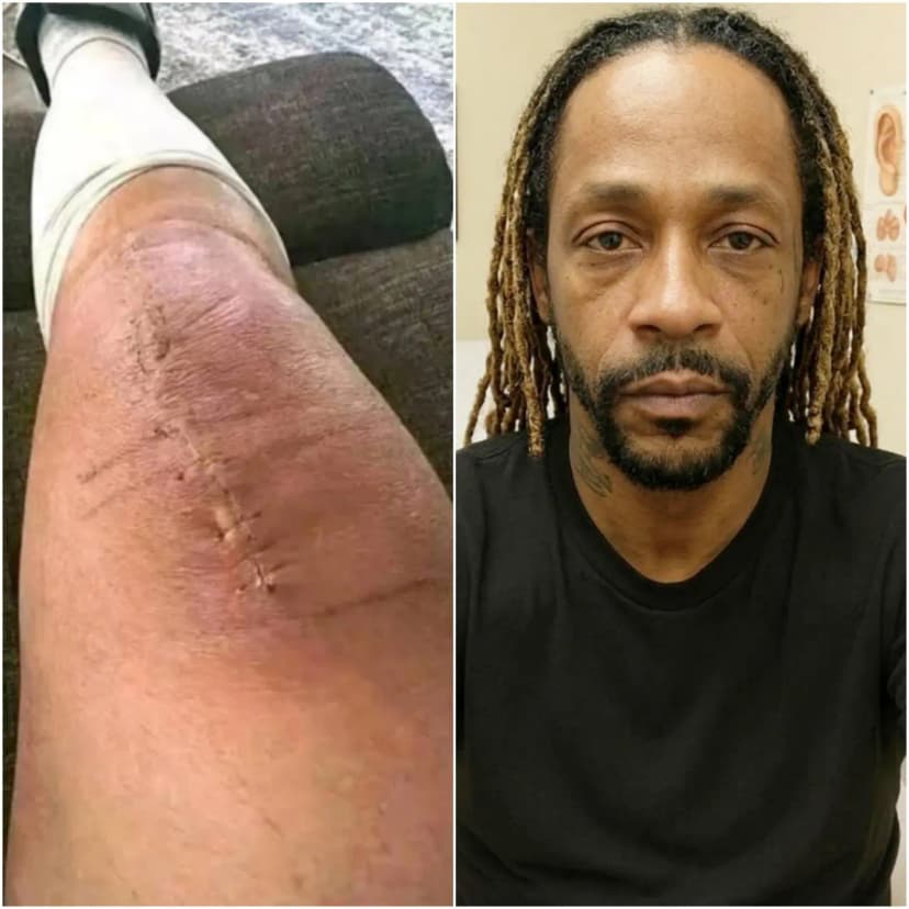 GOOD NEWS from Katt Williams: A heartfelt message after surgery 💬 “I still have a long road ahead. But I believe in healing — through love, through truth, and through the prayers from all of you.”